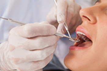 Zahnärztliche Untersuchung - Beurteilung des Zahnfleisches